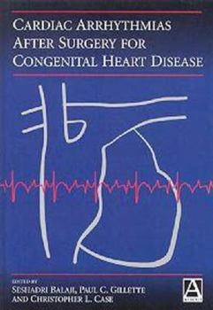 Hardcover Cardiac Arrythmias After Surgery for Congenital Heart Disease Book