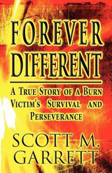 Paperback Forever Different: A True Story of a Burn Victim's Survival and Perseverance Book