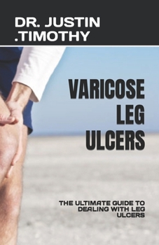 Paperback Varicose Leg Ulcers: The Ultimate Guide to Dealing with Leg Ulcers Book