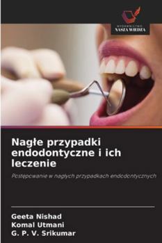 Paperback Nagle przypadki endodontyczne i ich leczenie [Polish] Book