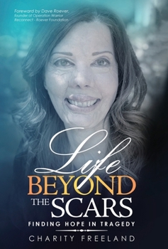 Hardcover Life Beyond the Scars: Finding Hope in Tragedy Book