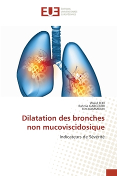 Paperback Dilatation des bronches non mucoviscidosique [French] Book