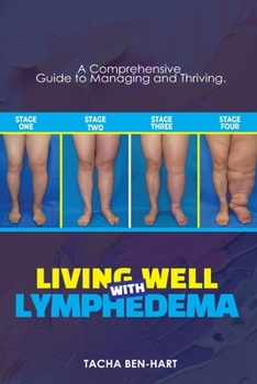 Paperback Living Well with Lymphedema: A Comprehensive Guide to Managing and Thriving Book