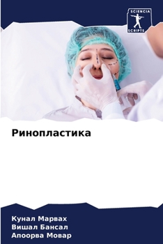 Paperback Ринопластика [Russian] Book