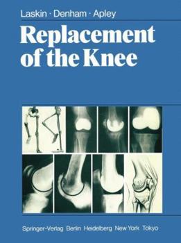 Hardcover Replacement of the Knee Book