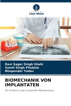 Paperback Biomechanik Von Implantaten [German] Book