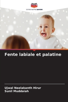 Paperback Fente labiale et palatine (French Edition) [French] Book