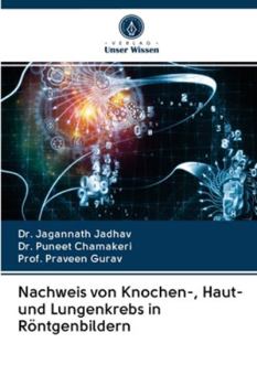 Paperback Nachweis von Knochen-, Haut- und Lungenkrebs in Röntgenbildern [German] Book