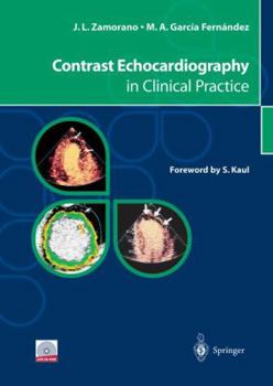 Hardcover Contrast Echocardiography in Clinical Practice [With CDROM] Book