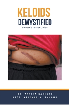 Paperback Keloids Demystified: Doctor's Secret Guide Book