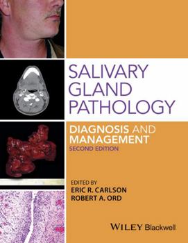 Hardcover Salivary Gland Pathology: Diagnosis and Management Book