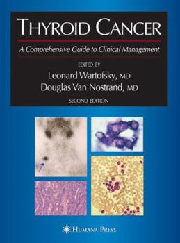 Paperback Thyroid Cancer: A Comprehensive Guide to Clinical Management Book