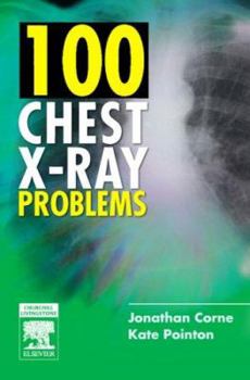 Paperback 100 Chest X-Ray Problems Book