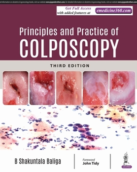 Hardcover Principles and Practice of Colposcopy Book