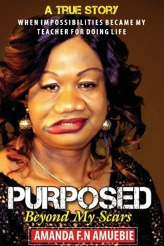 Paperback Purposed Beyond My Scars: When impossibilities Became My Teacher For Doing Life Book