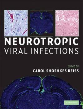 Hardcover Neurotropic Viral Infections Book