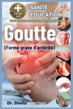 Goutte: forme grave d'arthrite: Causes, symptômes, gestion des modificateurs de risque, traitement, médicaments, prévention, alimentation et régime à ... et vivre avec le Goutte. (French Edition)