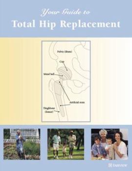 Spiral-bound Your Guide to Total Hip Replacement Book