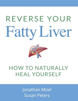 Paperback Reverse Your Fatty Liver: How To Naturally Heal Yourself Book