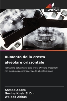 Paperback Aumento della cresta alveolare orizzontale [Italian] Book