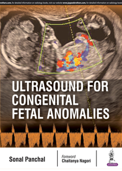 Paperback Ultrasound for Congenital Fetal Anomalies Book
