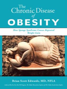 Paperback The Chronic Disease of Obesity: How Sponge Syndrome Causes Repeated Weight Gain Book