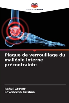 Paperback Plaque de verrouillage du malléole interne précontrainte [French] Book