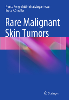Paperback Rare Malignant Skin Tumors Book