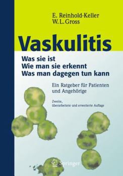 Paperback Vaskulitis: Was Ist Sie - Wie Man Sie Erkennt - Was Man Dagegen Tun Kann [German] Book