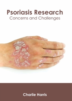 Hardcover Psoriasis Research: Concerns and Challenges Book