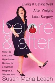 Before & After, Revised Edition: Living and Eating Well After Weight-Loss Surgery