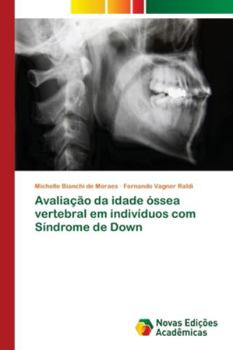 Paperback Avaliação da idade óssea vertebral em indivíduos com Síndrome de Down [Portuguese] Book