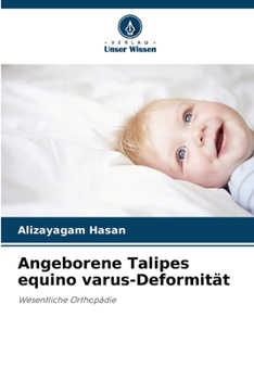 Paperback Angeborene Talipes equino varus-Deformität [German] Book