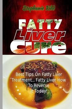 Paperback Fatty Liver Cure: Best Tips on Fatty Liver Treatment... Fatty Liver How To Reverse It Today! Book