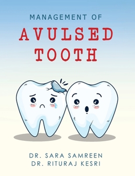 Paperback Management of Avulsed tooth Book