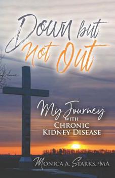 Paperback Down but Not Out: My Journey with Chronic Kidney Disease Book