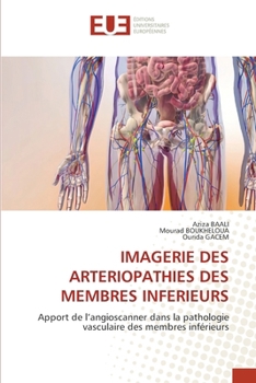 Imagerie Des Arteriopathies Des Membres Inferieurs