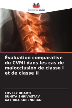 Évaluation comparative du CVMI dans les cas de malocclusion de classe I et de classe II (French Edition)