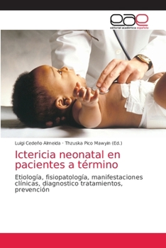Paperback Ictericia neonatal en pacientes a término [Spanish] Book