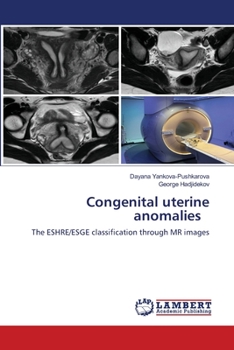 Paperback Congenital uterine anomalies Book
