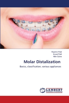 Paperback Molar Distalization Book