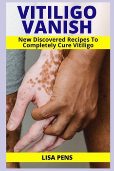 Paperback Vitiligo Vanish: Newly Discovered Secret Recipes To Completely Cure Vitiligo, Gain Your Self Esteem, Enjoy Your Clear Smooth Skin Again Book