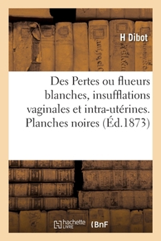 Paperback Des Pertes ou flueurs blanches, insufflations vaginales et intra-utérines: méthode nouvelle de traitement. Planches noires [French] Book