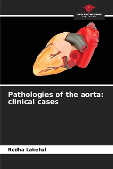 Paperback Pathologies of the aorta: clinical cases Book