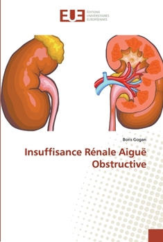 Paperback Insuffisance Rénale Aiguë Obstructive [French] Book