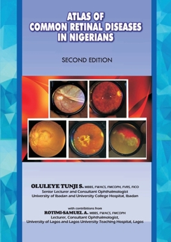 Paperback The Atlas of Retinal Diseases in Nigerians Book