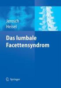 Paperback Das Lumbale Facettensyndrom [German] Book