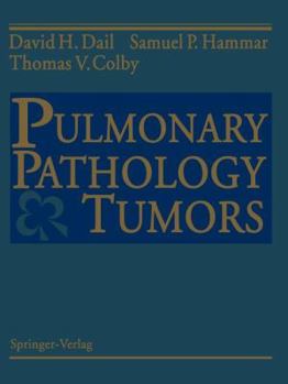 Paperback Pulmonary Pathology -- Tumors Book