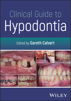Paperback Clinical Guide to Hypodontia Book