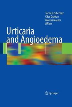 Paperback Urticaria and Angioedema Book